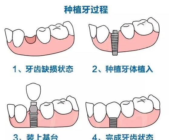 长春市牙科医院综合排名，你知道哪家补牙效果好且价格合理吗？