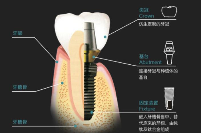 常州补牙医院哪家好？为您推荐当地口碑出众的常州牙科专家们！