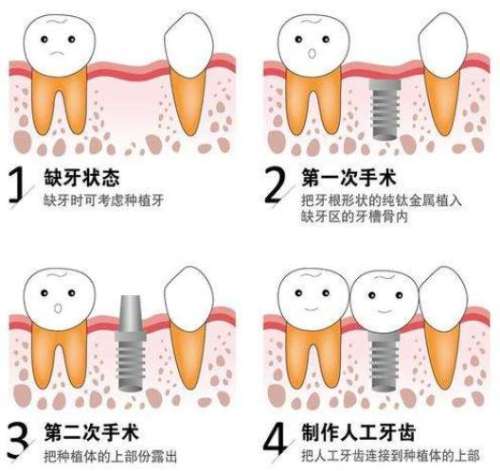 成都隐形矫正牙齿矫正医院推荐-口碑技术都不错！