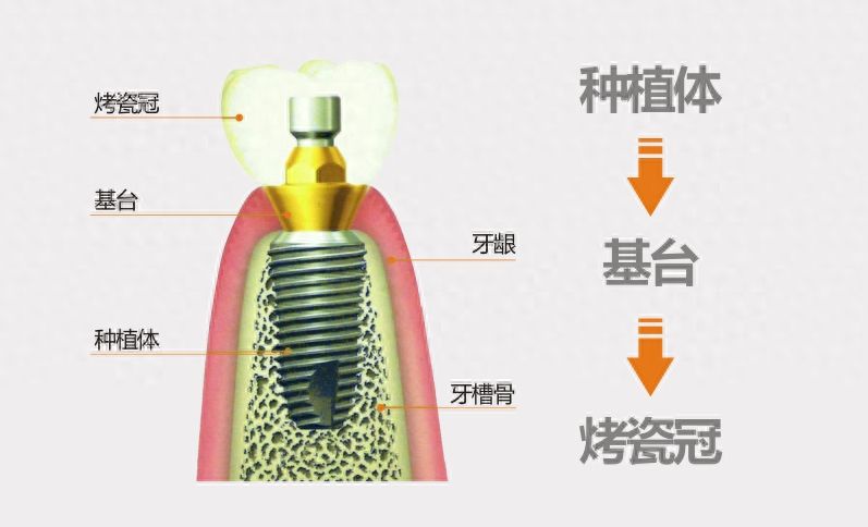 库尔勒门牙美容医院预约难吗？2024口碑前十榜单一览