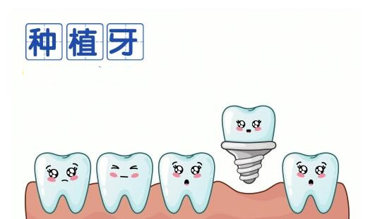 低价种植牙青岛口腔医院2023综合介绍：专家团队强势！