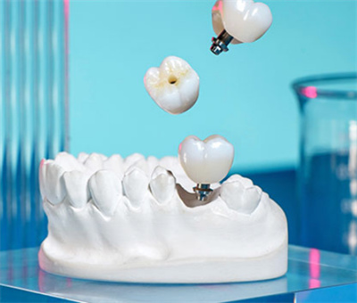 甘肃哪家牙科医院口碑比较好？牙齿整形技术比肩国际医疗水平
