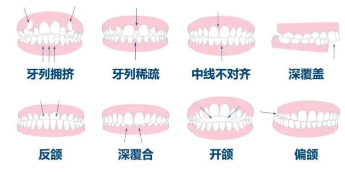 长沙经济实惠的植牙服务：提供高水准的技术实力与性价比之选！