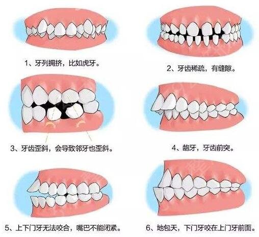 广东省种植牙哪家医院技术最先进？