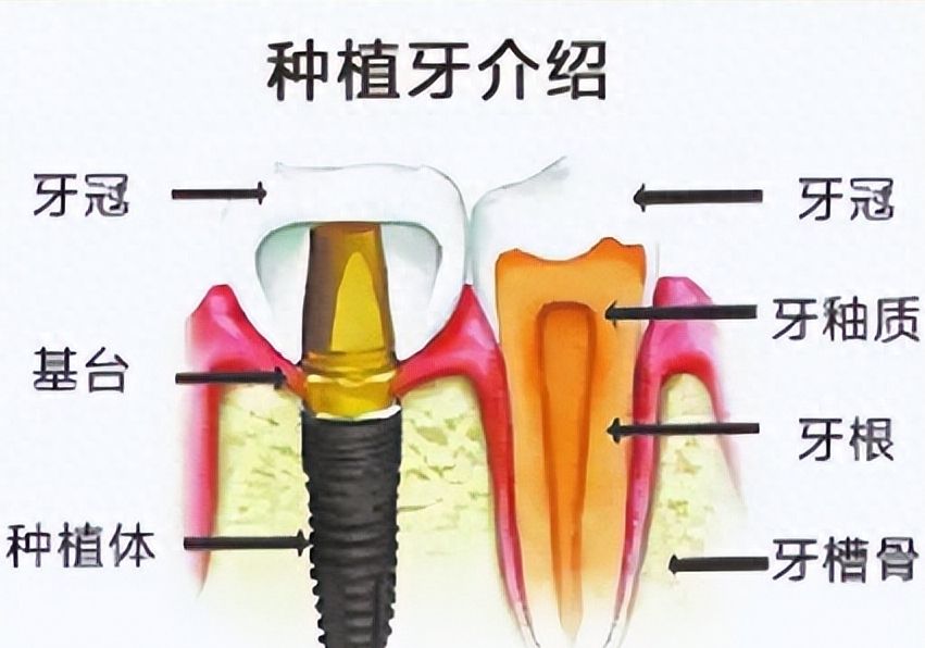 郑州牙根吸收矫正医院推荐：2024口碑排名前十参考