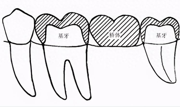 乌鲁木齐口碑佳的磨牙矫正齿科医院推荐