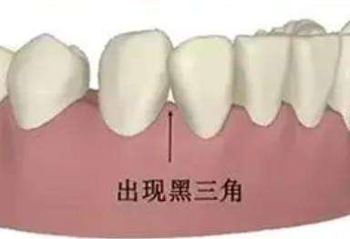 东莞仁华口腔医院：公立还是私立？费用适中更让人心动