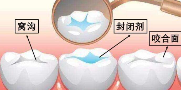 北京哪家医院镶牙效果好且价格合理？