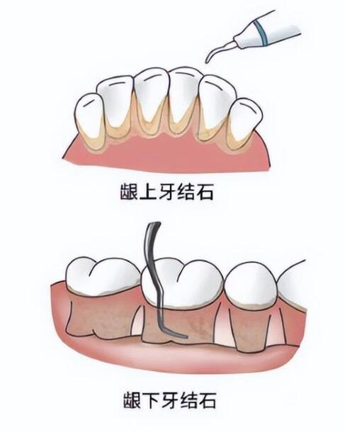 优质口腔医院首选，武汉地区口腔护理服务【全面解析】