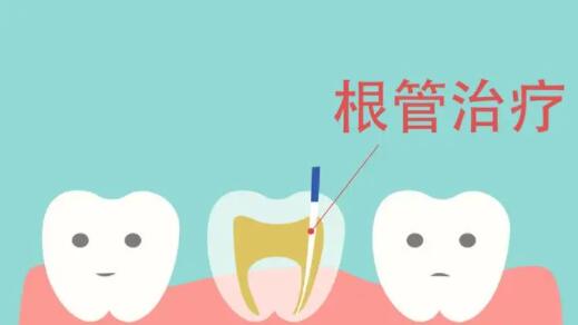 天津哪个地方有做全瓷牙的？选择靠谱的口腔诊所进行全瓷牙种植的最佳地点是哪里？