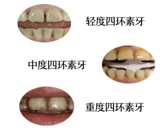 福州有哪些性价比高，技术好的牙科医院？