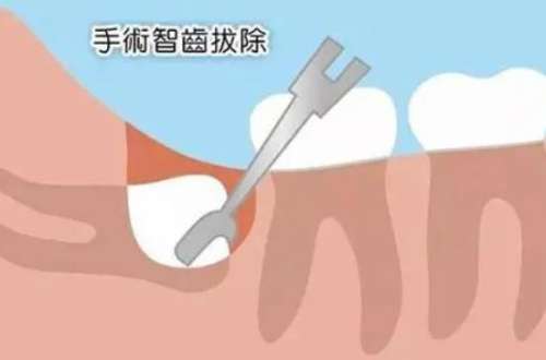 北京牙齿矫正医院推荐：口碑实力兼具的十佳之选