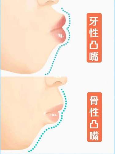 泰州口腔结缔组织移植推荐医院：2024年技术口碑分析