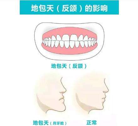 昆明后磨牙显微根管治疗哪家医院好？2024精选医院推荐！