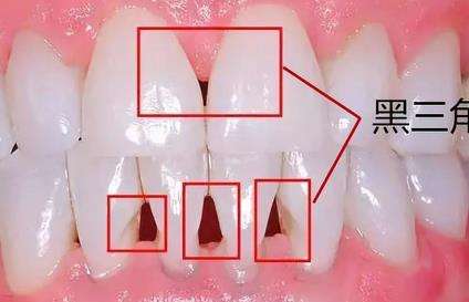 重视口腔健康！成都顶级公立医院为你盘点牙齿整形排行榜前十名