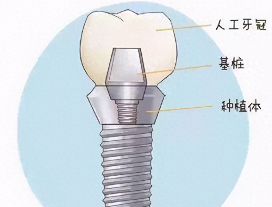 西宁做烤瓷牙哪家医院好？2024口碑推荐Top10