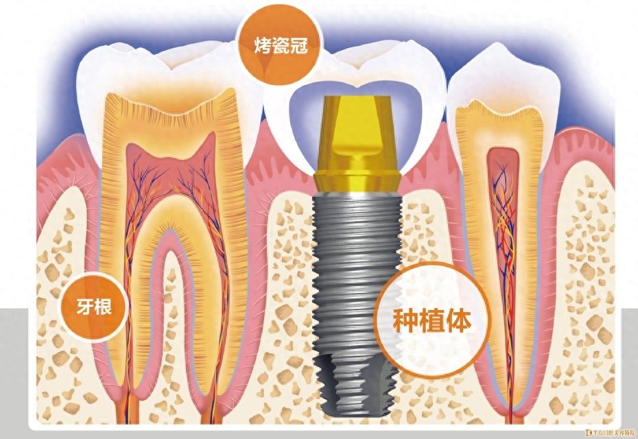 2024年呼和浩特牙齿矫正医院口碑十佳指南