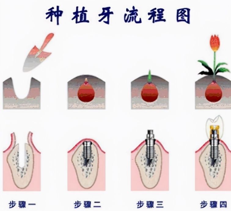 太原口碑好的洗牙喷砂医院推荐排名前十