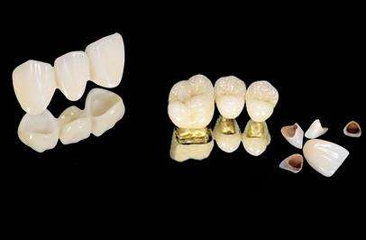 扬州全口种植牙修复好医院榜单：十大口碑优良口腔机构推荐
