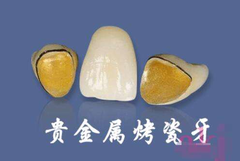 天津美奥口腔发布最新2023价格表：种植牙3899、牙齿矫正仅10800