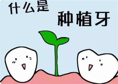 成都种植牙术后护理指南：推荐口碑医院合集