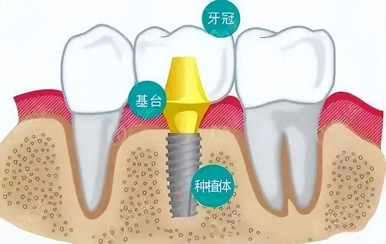 合肥牙龈增生激光治疗医院推荐：2024口碑之选