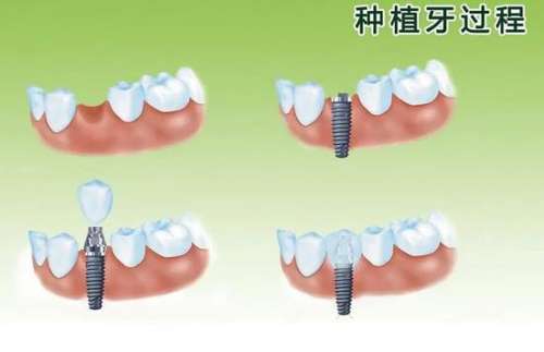 长沙哪家口腔医院实力悍，解决口腔问题当先