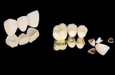 重庆3D全瓷牙医院推荐：口碑技术分析