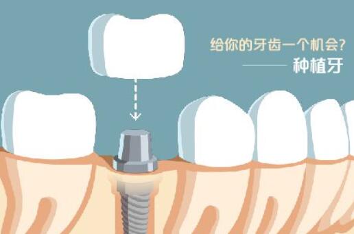 昆明口碑好的正颌手术医院排名参考-2024最新数据分析