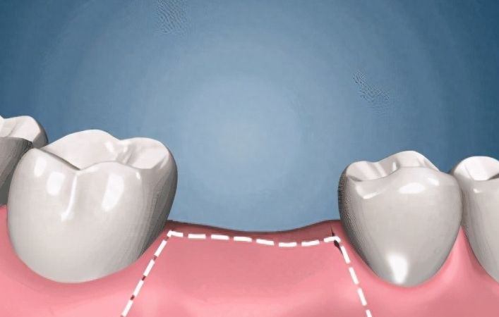 石家庄门牙补牙医院排行榜：10家口碑好技术佳