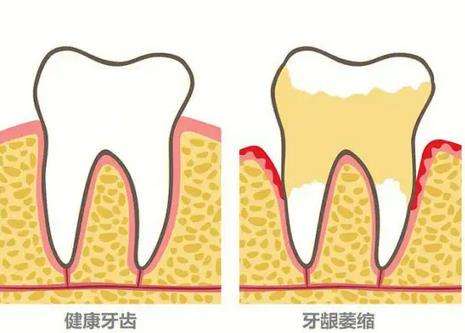 石家庄口腔医院矫正牙齿排名前十，让你快速摆脱牙齿拥挤不齐的烦恼！