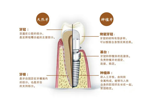 北京阻生牙医院推荐（精选10家）