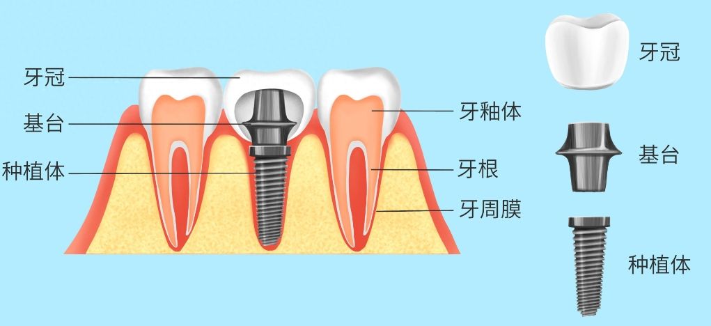 娄底冠状修复医院排行榜前10，口碑不容错过！