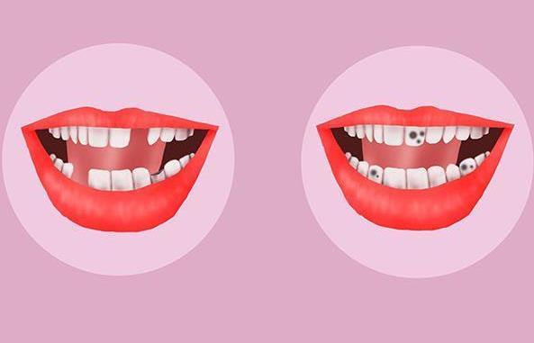 牙齿为什么会变黑，导致牙齿变黑的原因是什么?
