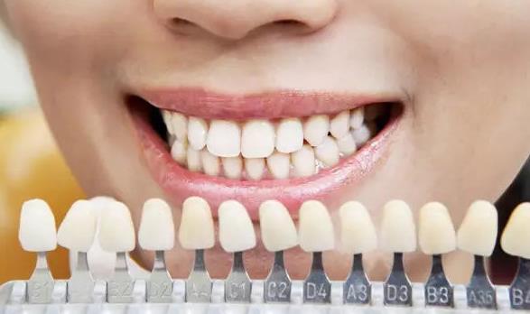 牙齿黑黑的是什么原因造成的？牙齿很黑是什么情况？
