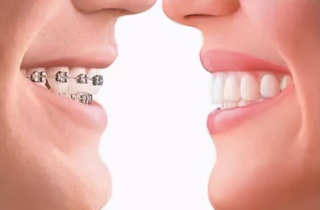 矫正牙齿一般是什么价格?矫正牙齿价格大概多少?