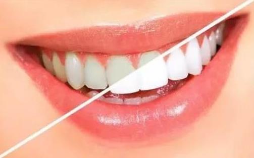 有什么实用的洗白牙齿的方法?