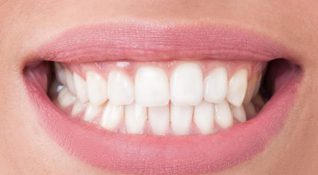 牙齿经常出血是缺什么?