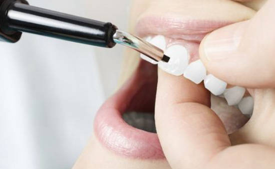 牙齿松动和牙周炎有关吗