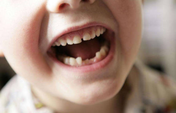 儿童牙齿松动是否可以自愈