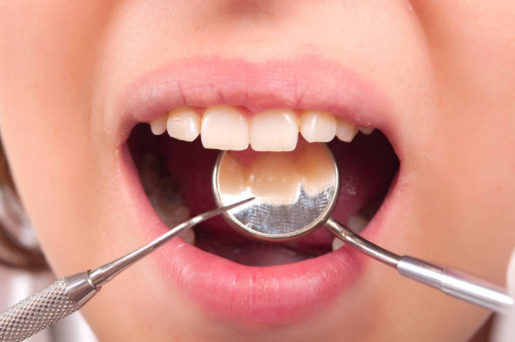 儿童牙齿松动能自己恢复吗