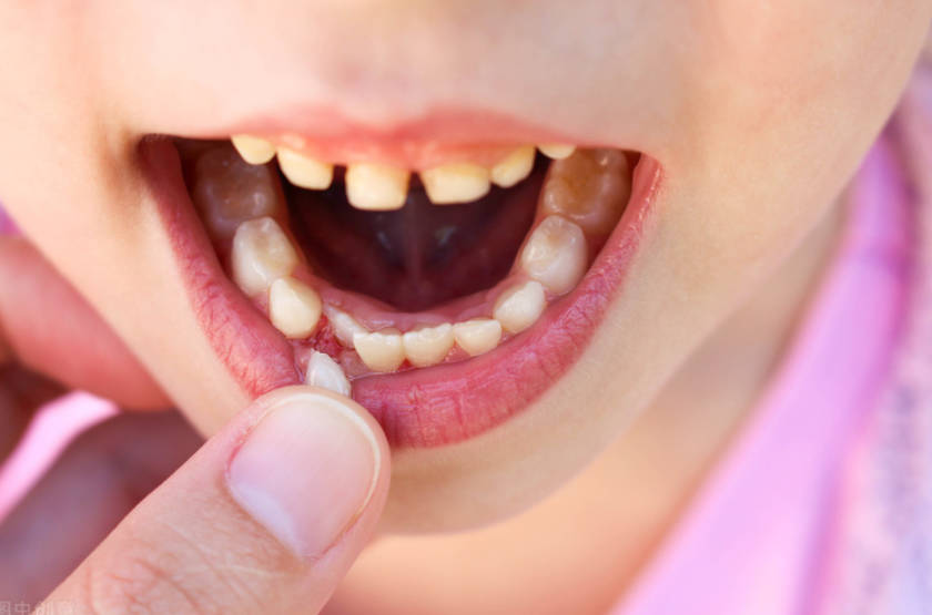 儿童牙齿有点松动能恢复吗