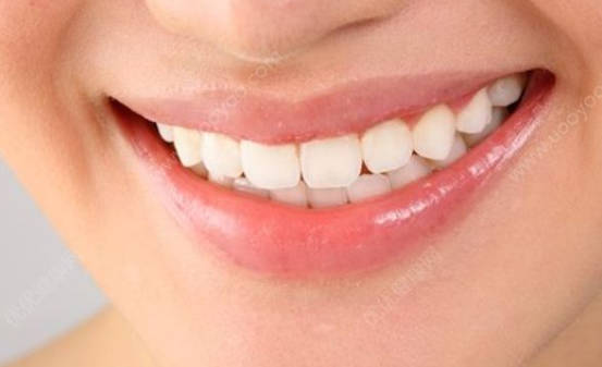 牙齿不白的原因有哪些？牙齿变白的方式有哪些？
