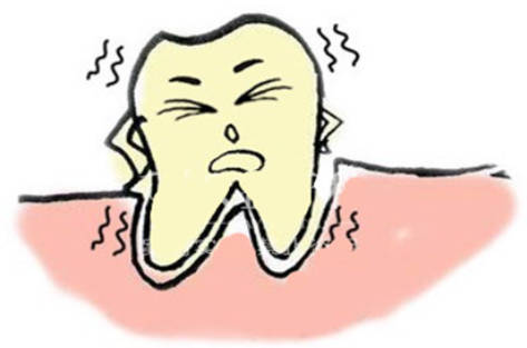 牙齿发炎的原因
