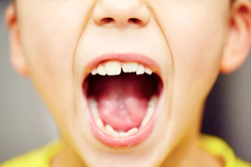 儿童如何预防牙龈炎