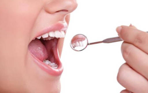 牙周炎治疗期间要注意的问题