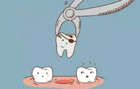 牙齿龋坏的主要原因