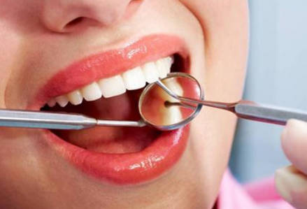 牙齿龋坏有哪几种类型