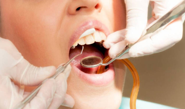 儿童如何防止牙齿龋坏？