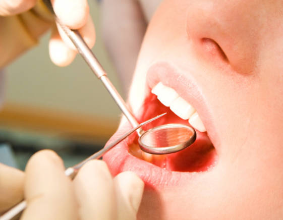 牙龈出血该如何治疗?